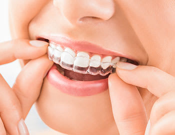 Invisalign Provider | Dr. Sophie DMD